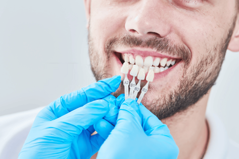 Implante Dentário pode ser Feito de Graça pelo SUS!