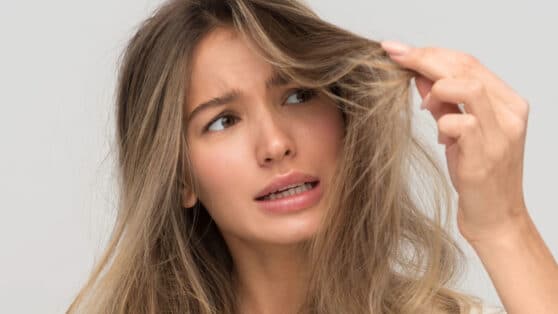 Scopri come gli alimenti giusti possono trasformare la salute dei tuoi capelli